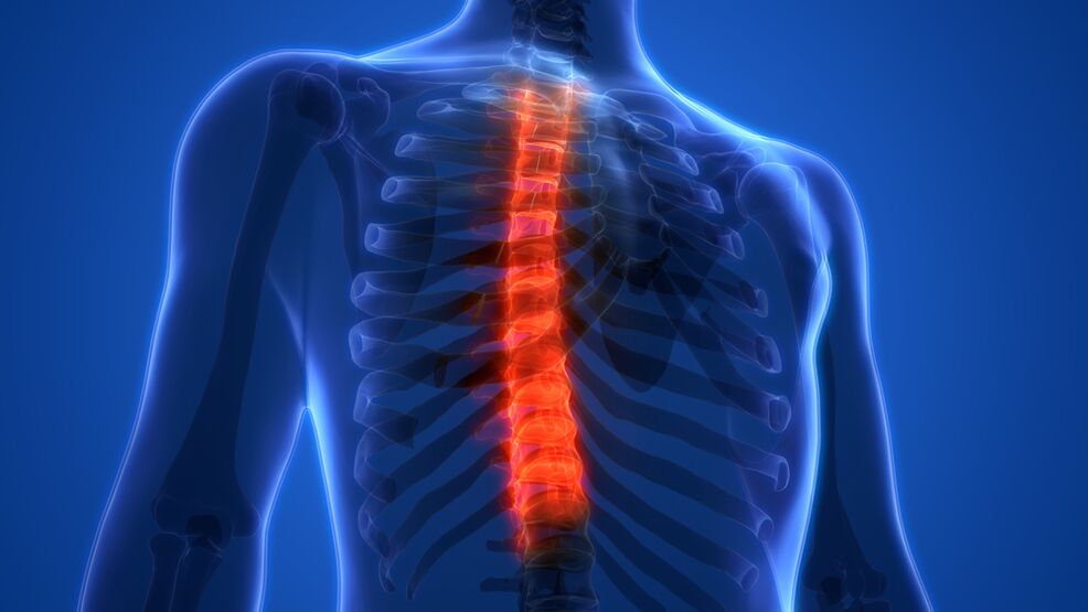 Krūškurvja mugurkaula osteohondroze