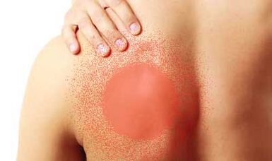 sāpes zem kreisā lāpstiņas