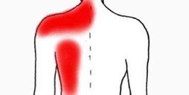 sāpes zem kreisās lāpstiņas no muguras