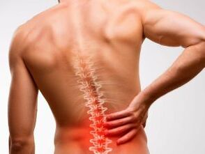 sāpes muguras lejasdaļā osteohondrozes dēļ